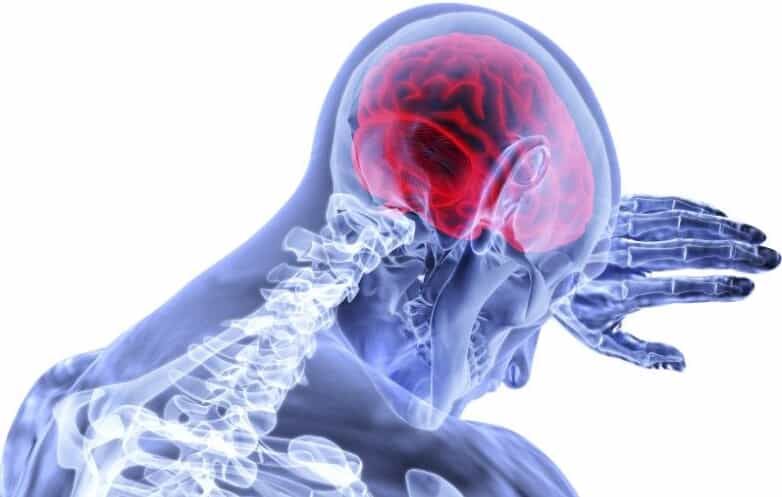 Brain injuries